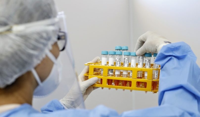 Governo do Ceará e Prefeitura de Fortaleza disponibilizam 9 unidades a partir desta segunda-feira (27). Foto: Tatiana Fortes/Gov. do Ceará.